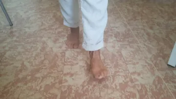 Vbočený palec - chůze