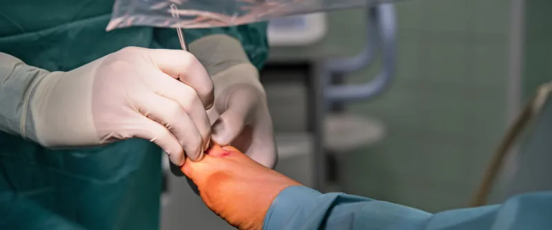 Estetická a miniinvazivní chirurgie nohy