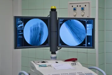 Estetická chirurgie nohy